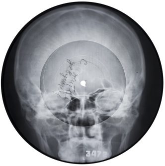 Unknown singer, “Just tell I love her,” late ‘50s-early ‘60s, Lathe-/hand-cut record on x-ray film, 22cm diameter, Courtesy X-Ray Audio, London, Garage Museum Of Contemporary Art Archive