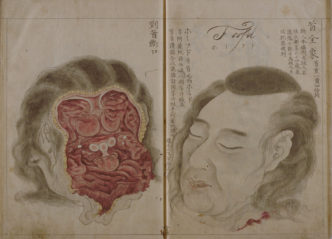 Kanzen Mikumo, Genshun Koishi, Ranshū Yoshimura, Seyakuin Kainantaizōzu, Japan, 1798, Manuscript with illustrations, ink and color on paper, RareBooks, Main Library, Kyoto University, Kyoto, Call no. 7-05/セ/1, Photograph courtesy of the Main Library, Kyoto University